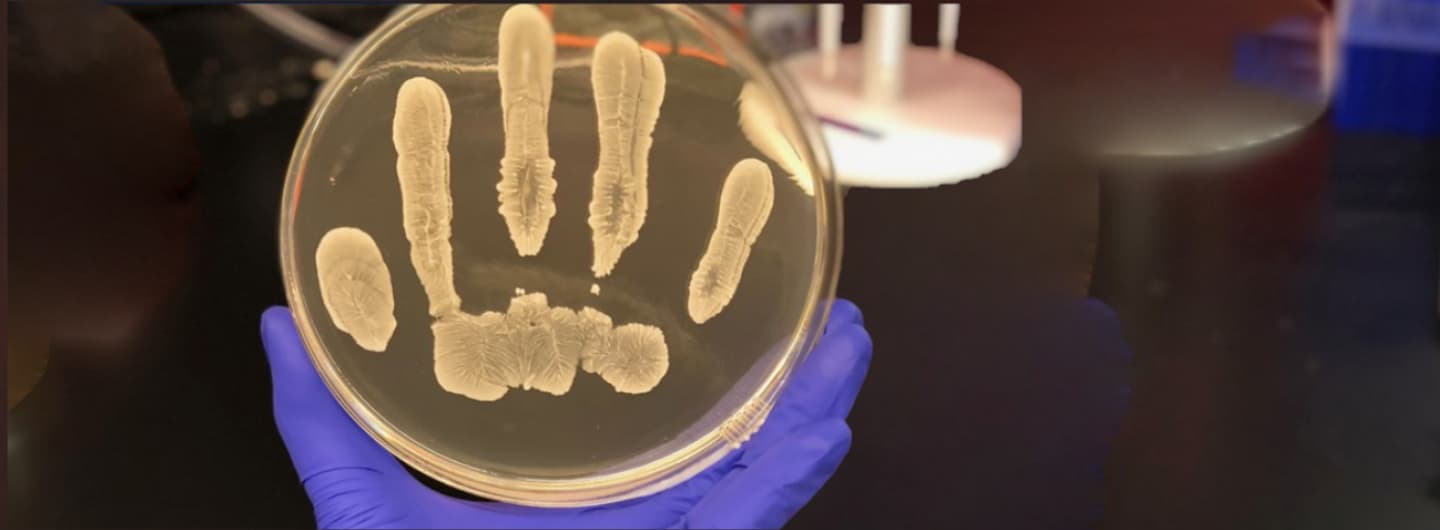 nakatsuji fingerprints in petri culture