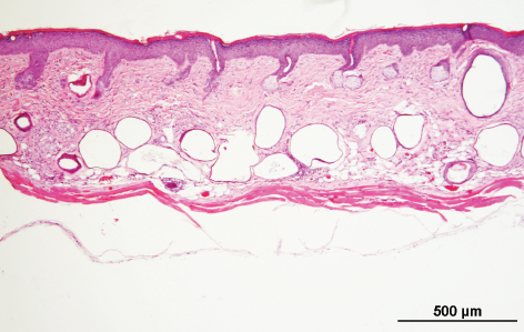 S. Epidermidis MO34