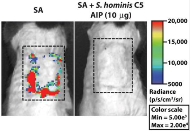 Staphylocococcus Aureus