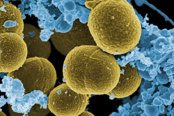 S. aureus aggravates skin conditions such as atopic dermatitis. Photo courtesy of NIAID